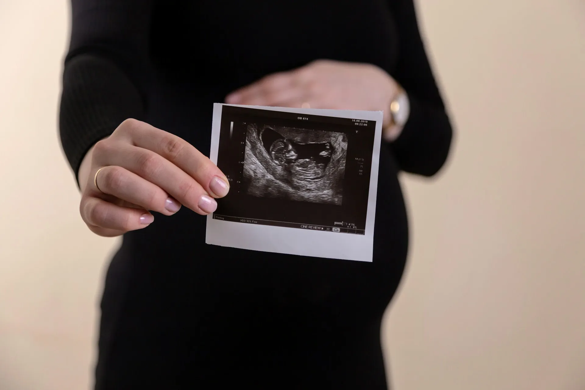 A pregnant woman with a photo of an ultrasound